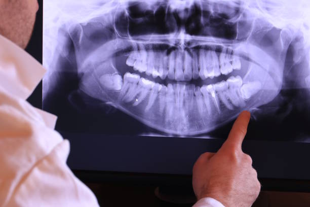 Best Walk-In Emergency Dental Services in Long Lake, IL